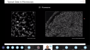 برگزاری کارگاه تخصصی جناب آقای دکتر پژمان راستی دانشیار دانشگاه آنژه فرانسه، با موضوع « Segmentation in ۲D and ۳D Microscopy Image Stacks »
